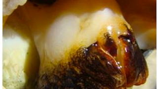 Penises Grow On Female Snails' Heads After Chemical Exposure